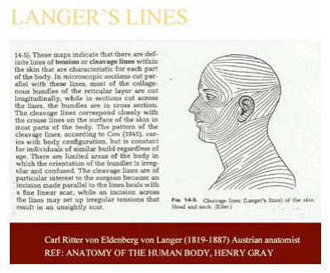 Langers Lines Diagram