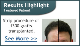 Patient Results 1300 grafts transplanted