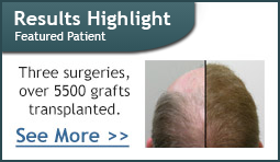 Patient Results 5500 grafts translplanted