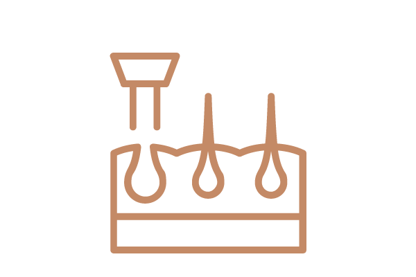 A simple line drawing of a skin cross-section with three hair follicles and a device applying treatment to one follicle.