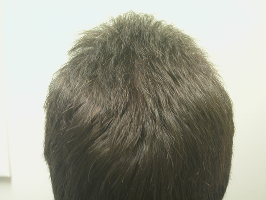 The image shows the back of a person's head with short, dark brown hair against a plain light background.