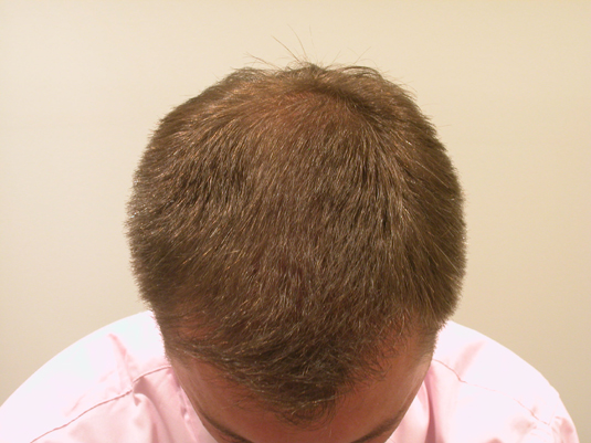 A man with short, brown hair is looking down, revealing thinning hair on the top of his head.