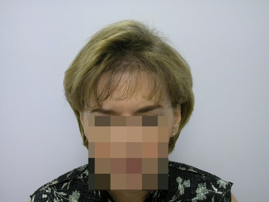 A person with short light brown hair is facing the camera; their face is pixelated to obscure their identity.