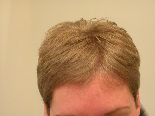Close-up of the top of a person's head with short, light brown hair against a plain beige background.