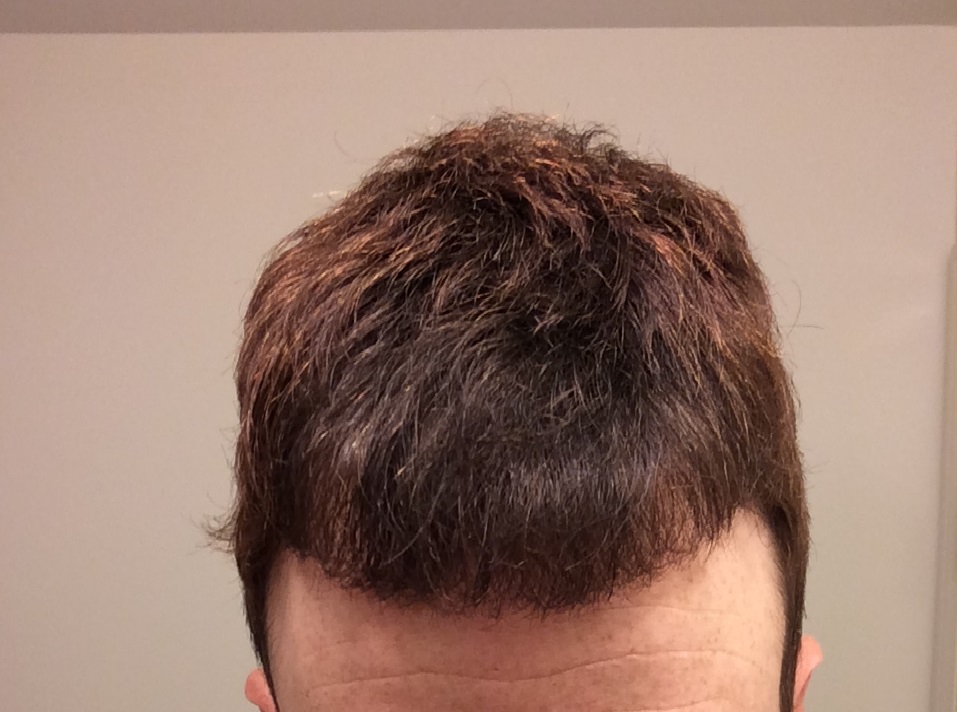 Close-up view of the top of a person's head with short, slightly messy brown hair, against a plain light-colored background.