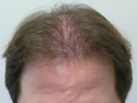 Prior to treatment with Dr. Wolf