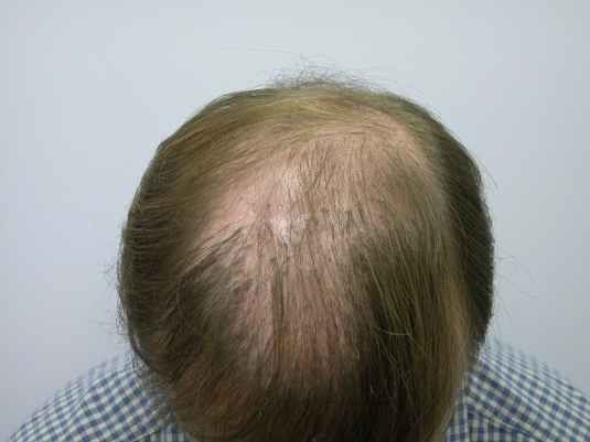 Prior to treatment with Dr. Wolf