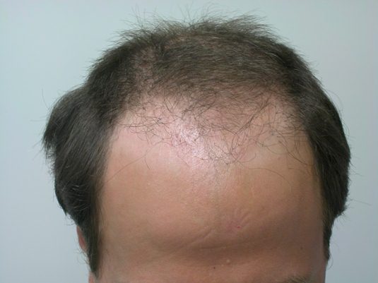 Before surgery