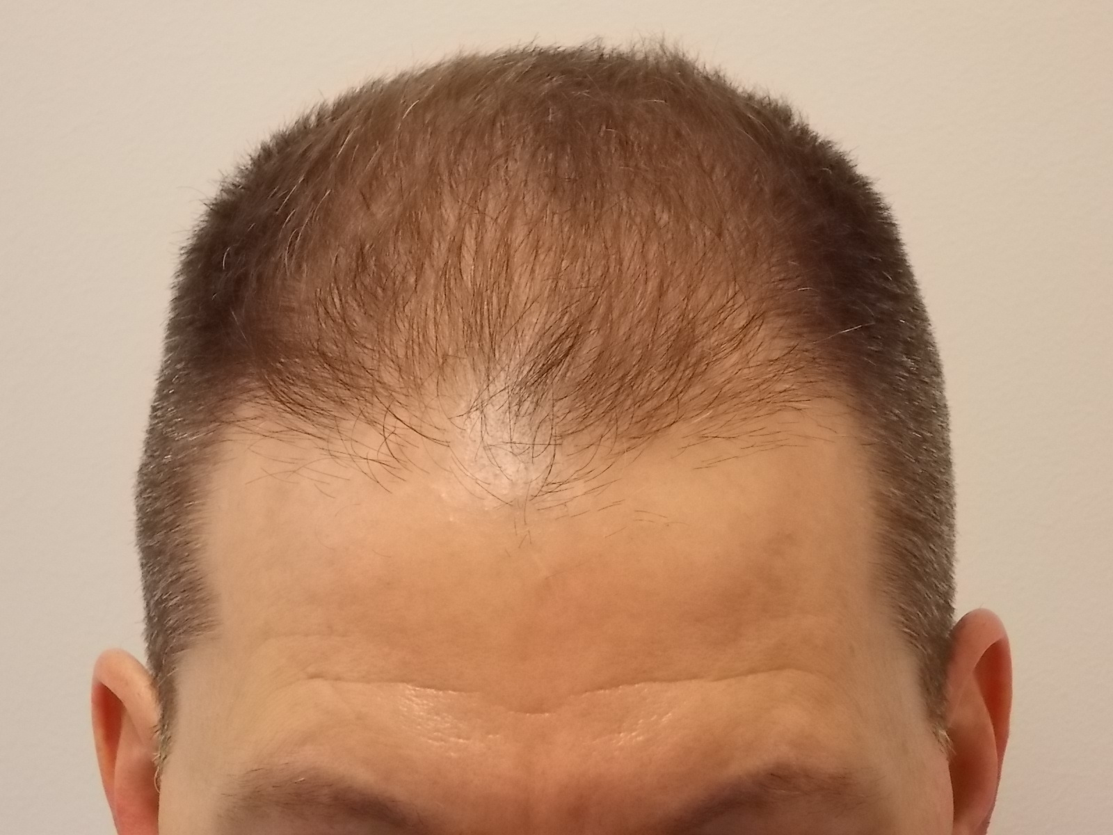 Before surgery