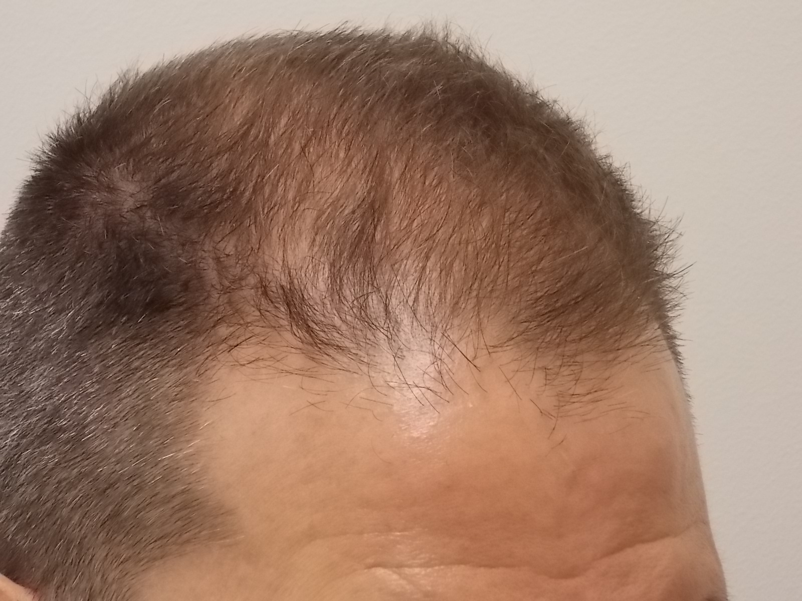 Before surgery